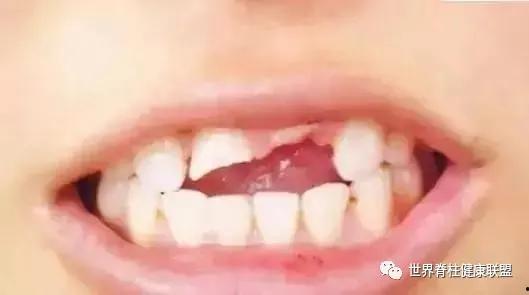 门牙缺失吃瓜,吃瓜也能吃出生活新滋味